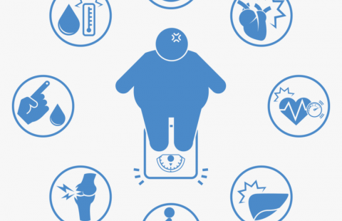 An illustration of an obese person and the major risks associated with being obese.
